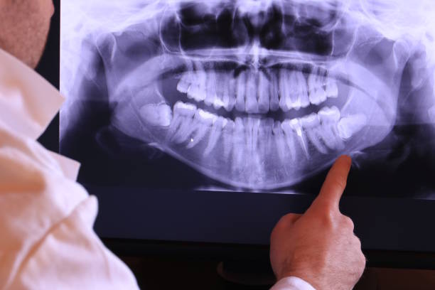 Best Dental Abscess Treatment in Fort Mohave, AZ